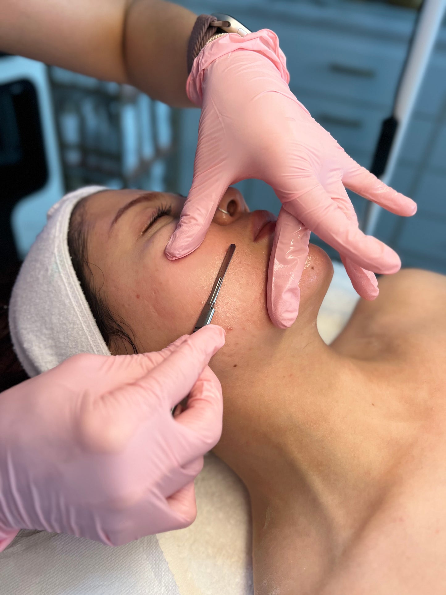 Dermaplaning