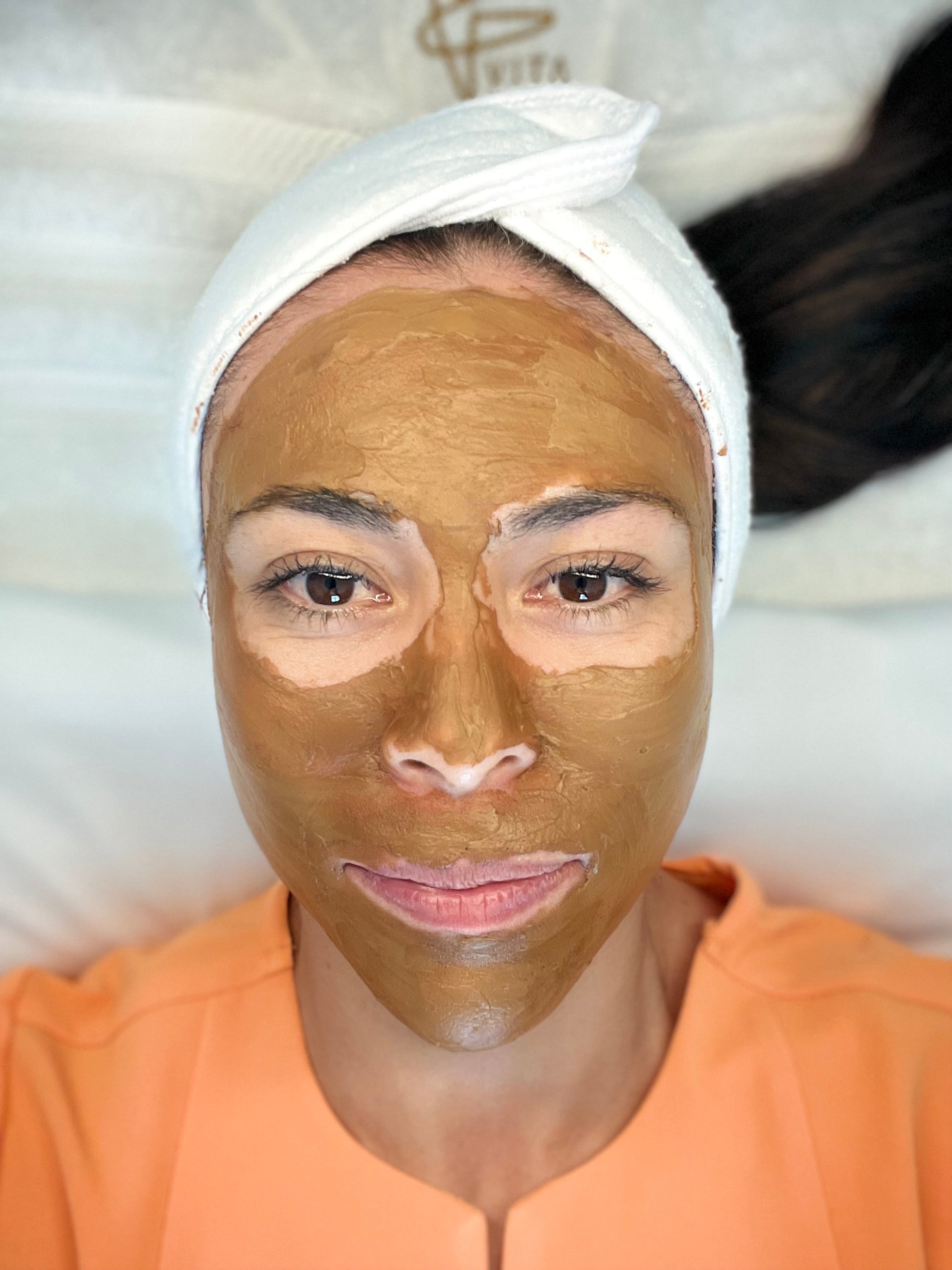 Cosmelan – Vita Bella Medical Spa