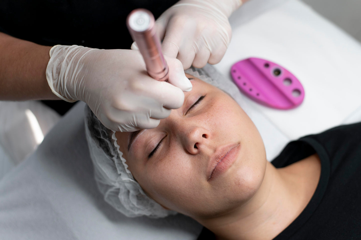 Plasma Fibroblast Browlift