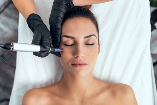 Microneedling with Filorga